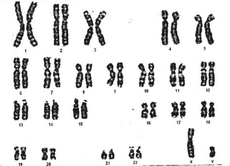 На рисунке приведены фотографии нескольких хромосом разных