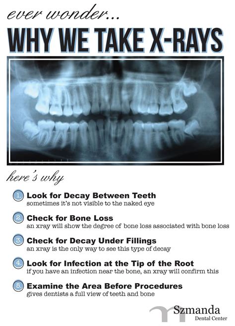 When planning pregnancy (to identify hidden infections and timely treatment); The 411 on Dental X-rays | Dentist in Wittenberg, WI