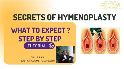 Secrets Of Hymen Repair 3 Different Case Of Hymenoplasty YouTube
