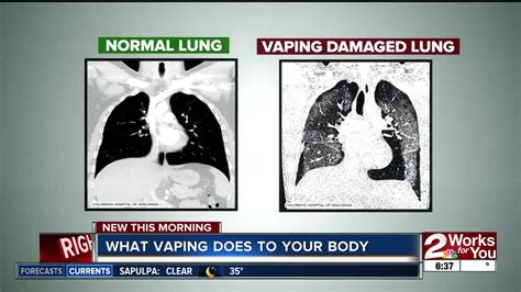 What Vaping Does To Your Body