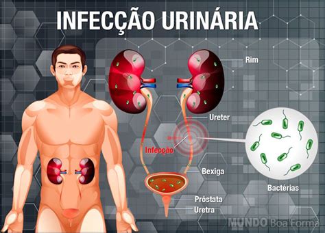 Infec O Urin Ria No Homem Sintomas Causas E Tratamento Mundoboaforma