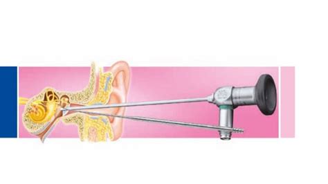 Instrument Set For Endoscopic Middle Ear Surgery Broadcastmed