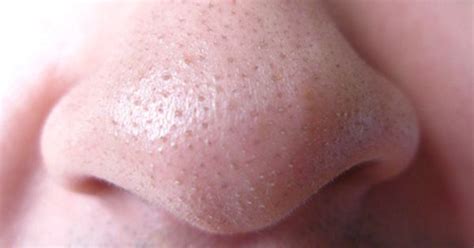 Well, to do that, you need to understand first how pores work in the first place. Those aren't blackheads all over your nose! How to deal ...