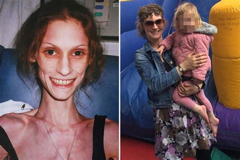 brave mum who dropped to just four stone while battling anorexia has since turned her eating