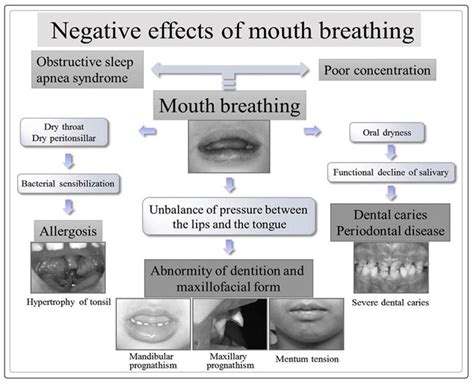 mouth breathing symptoms and causes dentist ahmed official website