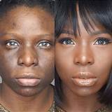 Pictures of Makeup To Cover Skin Pigmentation