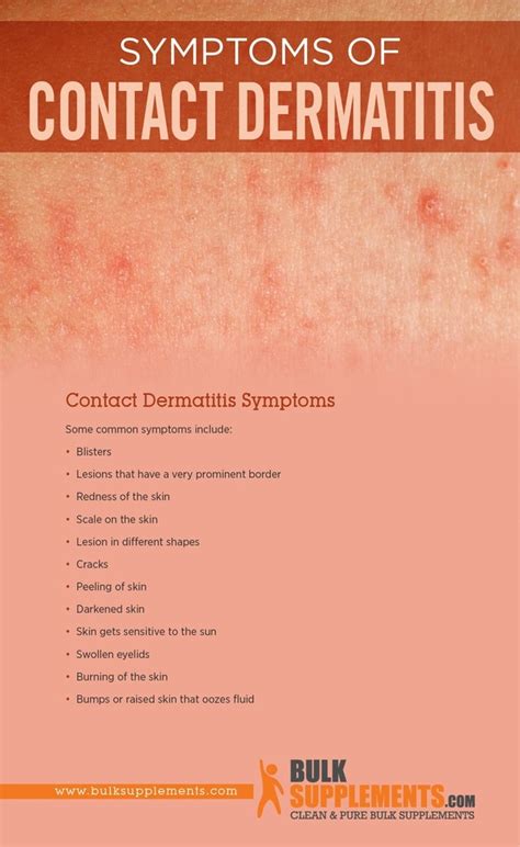 Contact Dermatitis Symptoms Causes And Treatment