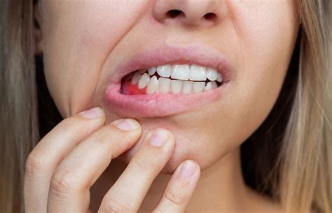 15 Home Remedies For Swollen Gums And Prevention Tips