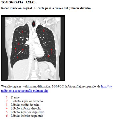 Blog De Anatomía Radiológica Humana Unad Grupo 15400340 2018