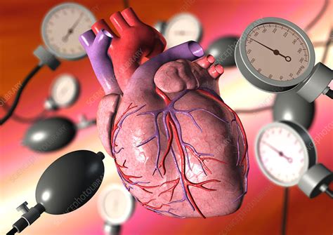 High blood pressure - Stock Image - M172/0592 - Science Photo Library