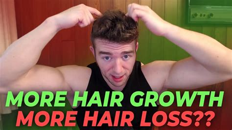 More Hair Growth On Your Body More Hair Loss On Your Head Youtube