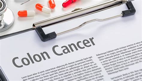Colon Cancer Survival Rate Moffitt