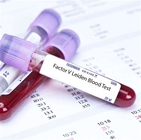 Factor V Leiden Blood Tests In London