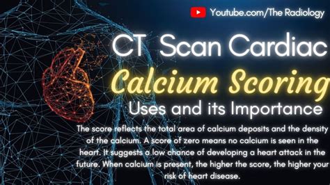 Calcium Scoring Ct Cardiac Youtube