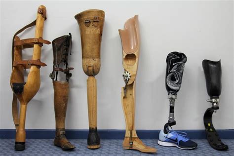 Advancements Of Prosthetic Limbs The Roaring Times