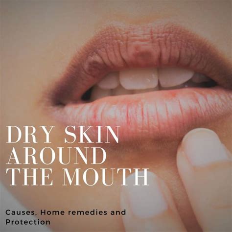 Dry Skin Around The Mouth Causes Home Remedies And Protection