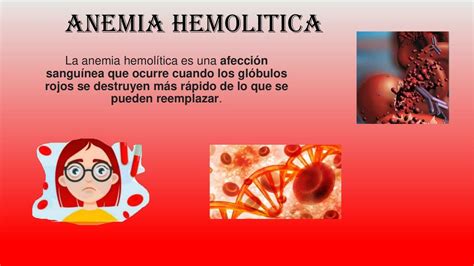 Anemia Hemolítica Milk Cuellar Udocz