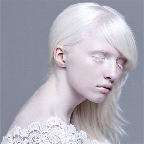 Best Images About Albino People On Pinterest Models Africa And Albino Model