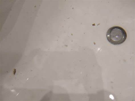 Принимаю диане 35 как похудеть Коричневые ошметки - Вопрос гинекологу - 03 Онлайн Коричневые ошметки - Вопрос гинекологу - 03 Онлайн Принимаю диане 35 как похудеть