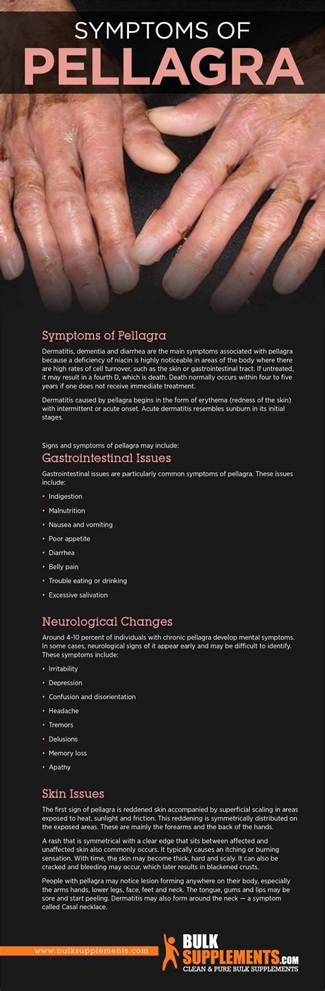 Pellagra Symptoms Causes And Treatment
