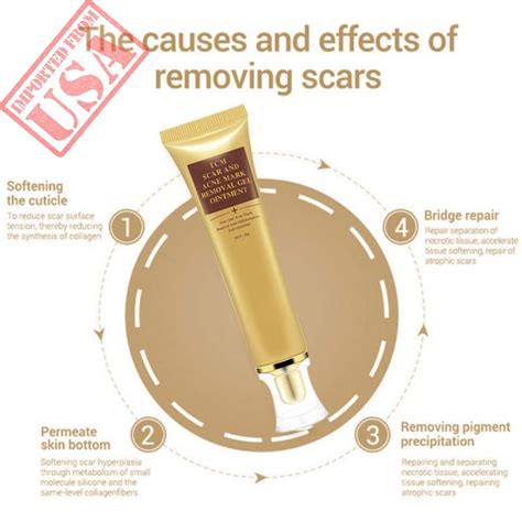 Scar Cream Acne Scar Removal Creamacne Spots Treatmentstretch Marks