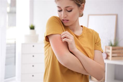 Come Curare La Dermatite Da Stress I Migliori Rimedi Mbenessere