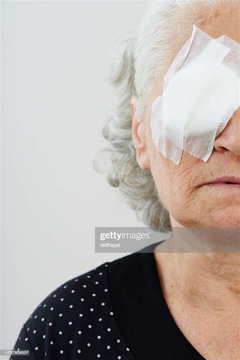 Elder Female With Eye Patch High Res Stock Photo Getty Images