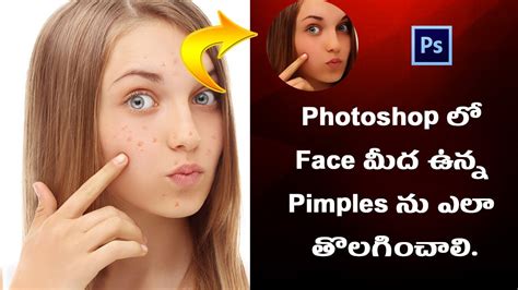 How To Remove Pimplesacne In Photoshop Photoshop 2020 Youtube