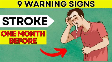 Dont Ignore 9 Warning Signs Of Stroke One Month Before Daily Joy Youtube