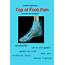 Top Of Foot Pain Running  All You Need Infos