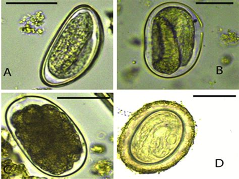 Images Of Nematode Eggs A Enterobius Spp B Strongyloides Spp