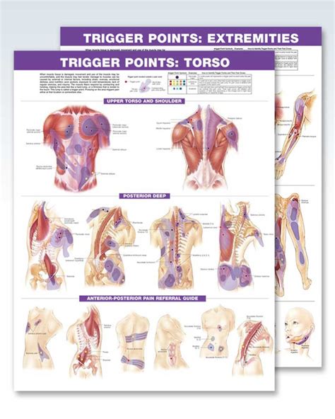 Trigger Points Set Exam Room Anatomy Posters Clinicalposters