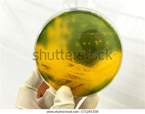 Vibrio Cholerae On Tcbs Agar Yellow Stock Photo 571285108 Shutterstock