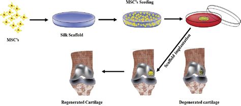 Bombyx Mori Derived Scaffolds And Their Use In Cartilage Regeneration