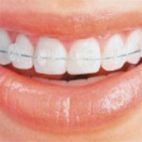 Orthodontic Dentistry Services 3dent