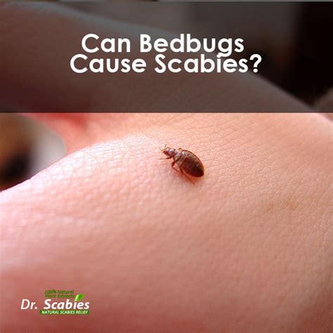Can Bedbugs Cause Scabies Drscabies