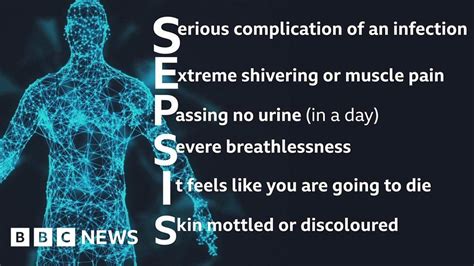 sepsis what is it and how to spot it