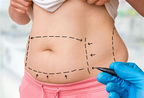 The Benefits Tummy Tuck With Other Surgeries