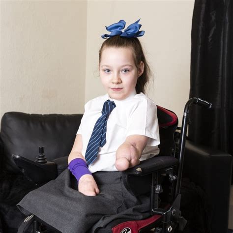 Incredibly Brave Nine Year Old Amputee Is Dreaming Of A Bionic Hero Arm To Allow Her To Dress