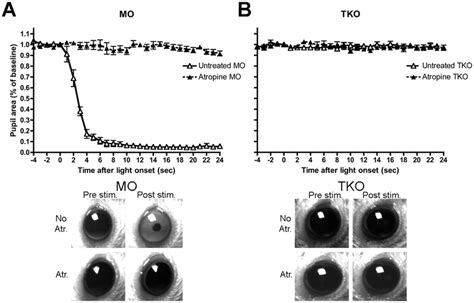 Effect Of Atropine On Pupil Size In A Mo Rdrd Cl And B Tko