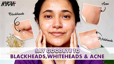 How To Remove Clogged Pores At Home Get Rid Of Blackheads Whiteheads