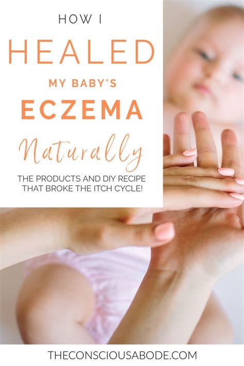 Natural Eczema Solution That Actually Works Dry Skin Home Remedies