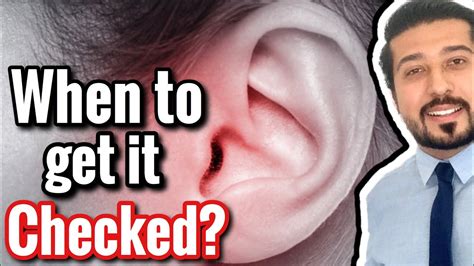 Ear Infection Or Otitis Media Should You See A Doctor Youtube