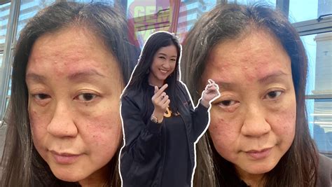 Video Alahan Pada Ubat Punca Muka Dj Lin Naik Bengkak And Merah “saya