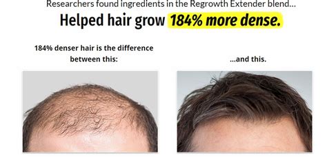 Keeping the scalp and hair clean may also prevent hair damage and loss. Best Hair Loss Treatments for Men: Proven Ways To Regrow Hair