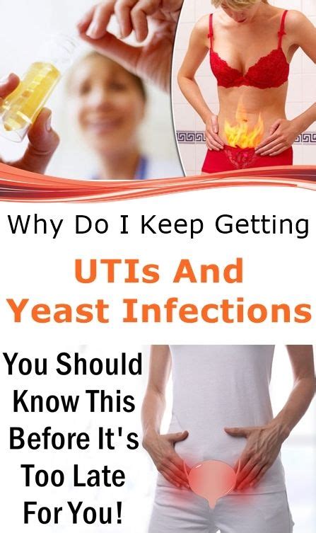 Why Do I Keep Getting UTIs And Yeast Infections Yeast Infection