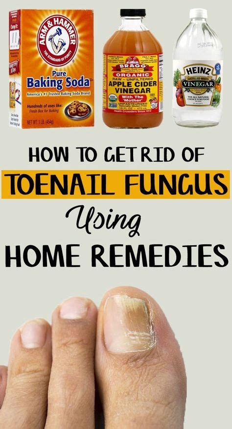 9 Best Nail Fungus Removal Images Home Remedies Fungi Natural Remedies