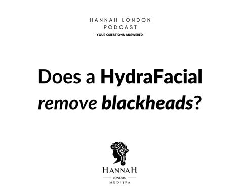 Does a HydraFacial remove blackheads? - Hannah London