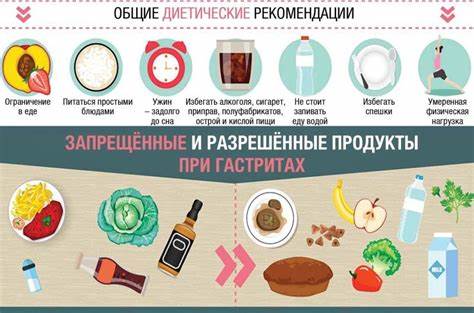 Лечение гастрита диета Обострение гастрита: симптомы, лечение и диета Обострение гастрита: симптомы, лечение и диета Лечение гастрита диета