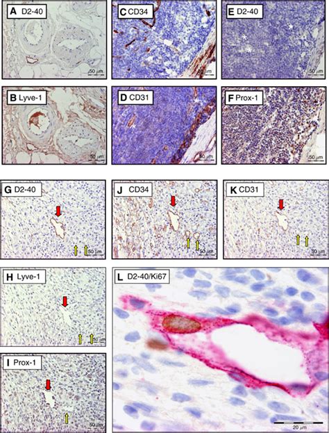 Overview Of The Immunohistochemical Stains Used On Serial Sections Of A